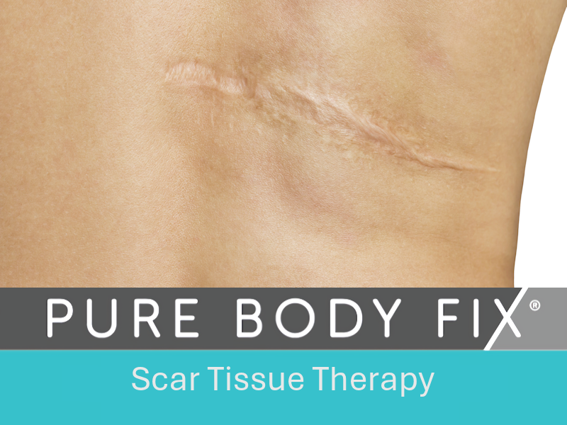 ScarTissue Therapy