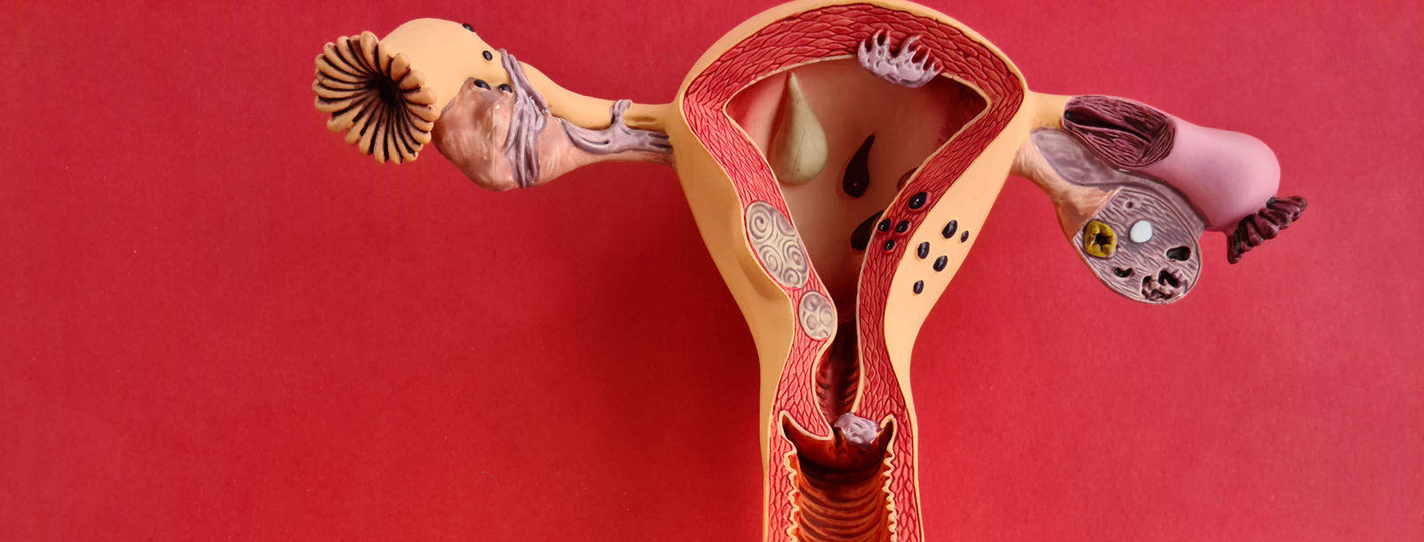 Menopause Coaching